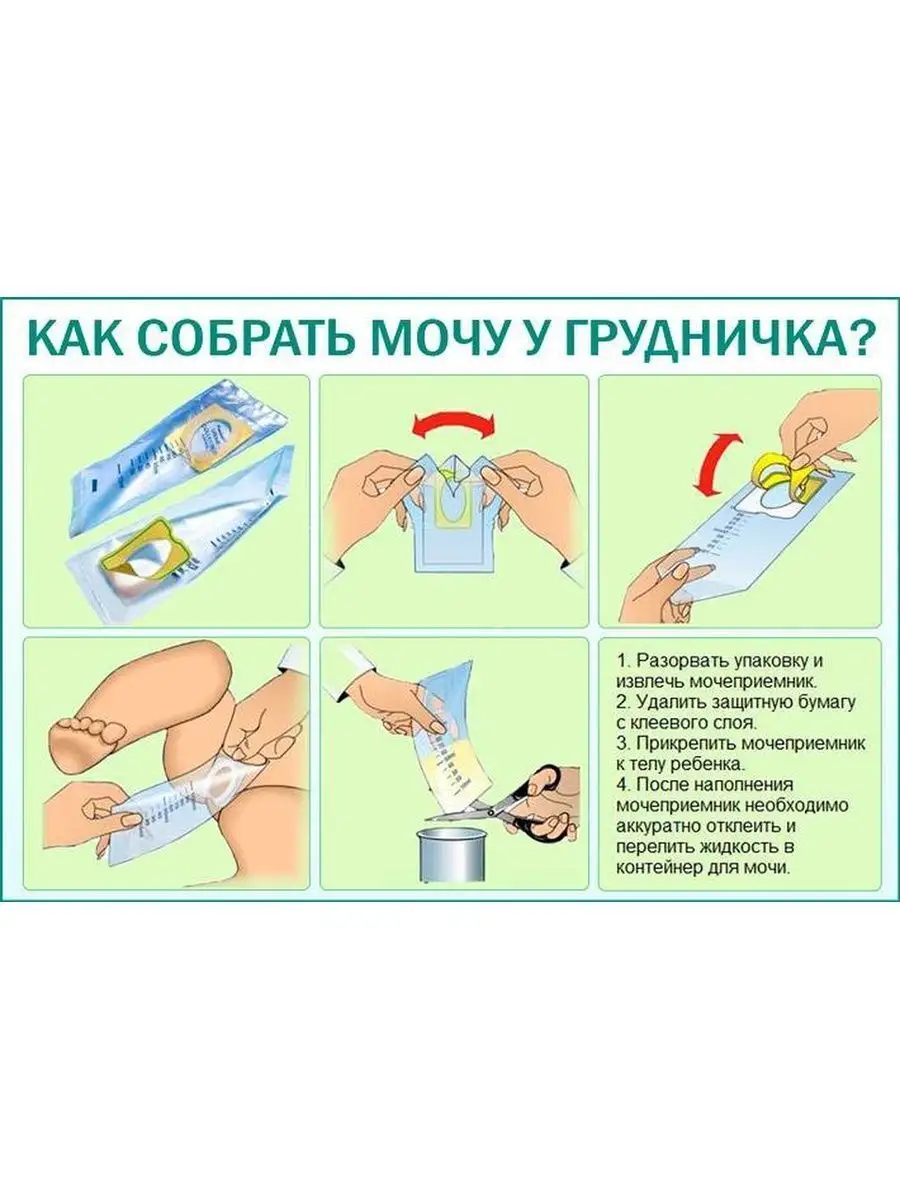 Как у грудничка собрать мочу
