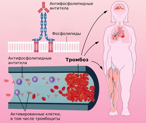 Кровь на афс что это