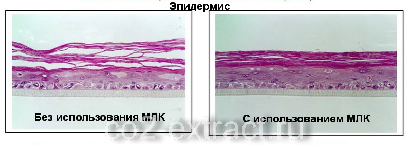 Липидный комплекс что это такое
