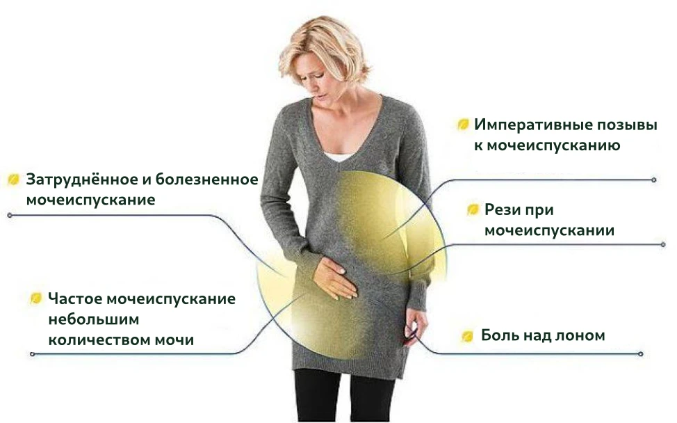 Моча при цистите у женщин
