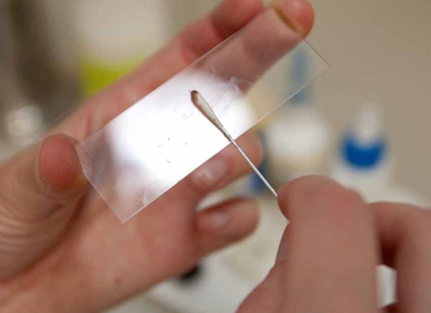 Мазок на зппп это что