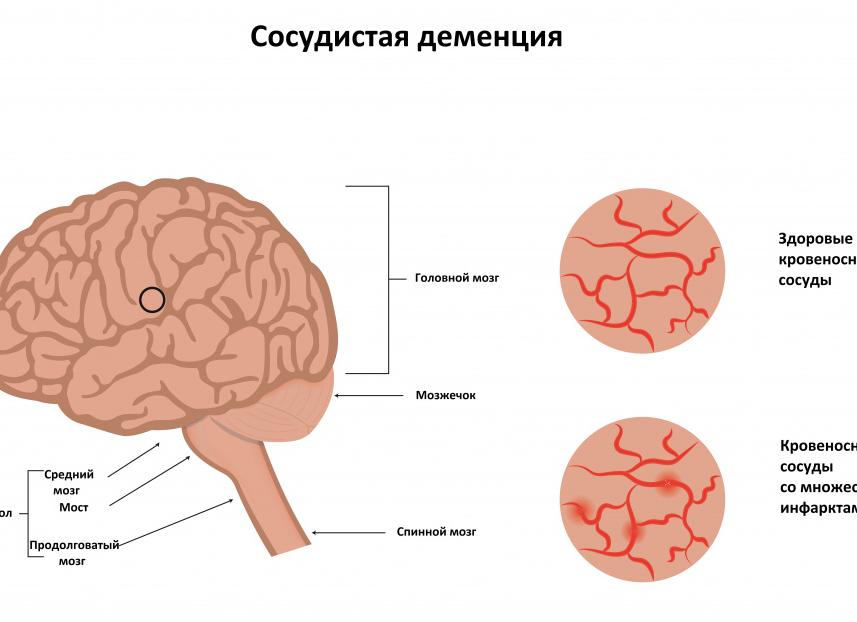 Гомоцистеин как сдавать