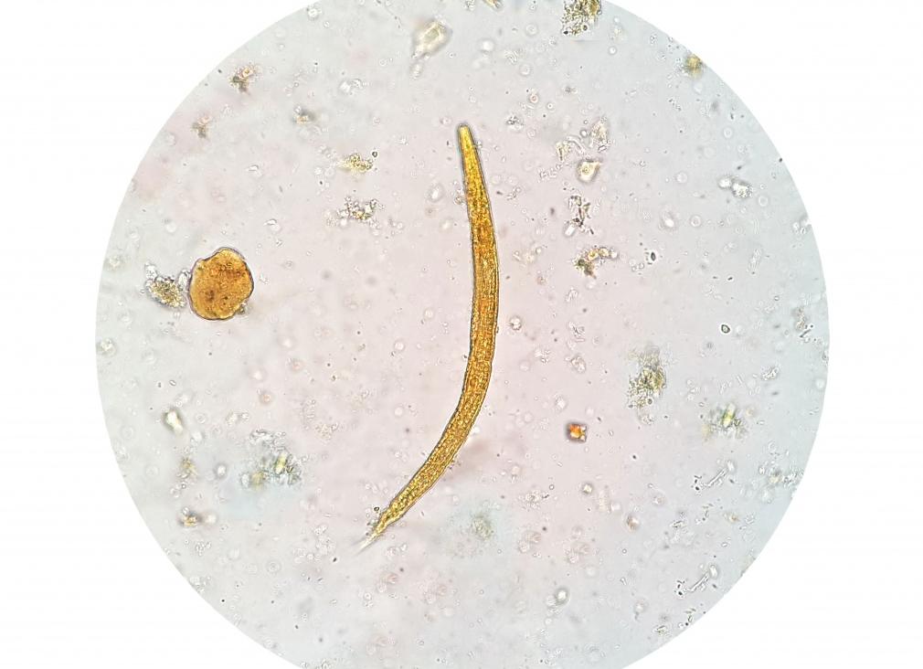 Цисты лямблий в кале у ребенка