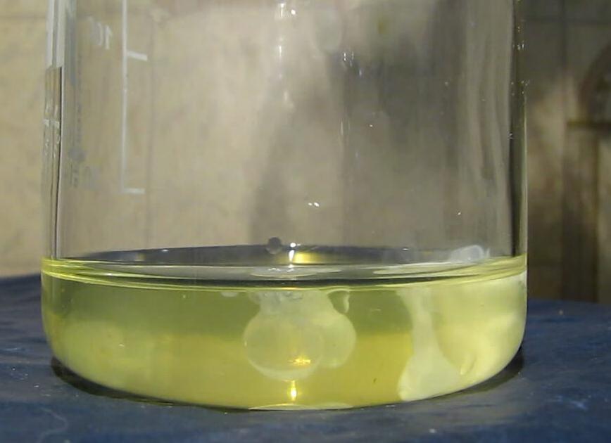 Что значит слизь в моче