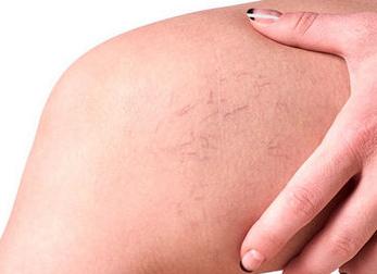 Анализ афс что это Анализ афс что это