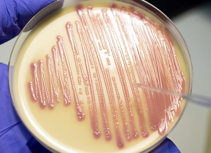 Микрофлора обильная палочковая что это Микрофлора обильная палочковая что это