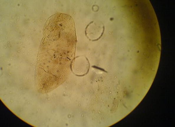 Йодофильная флора в кале у грудничка