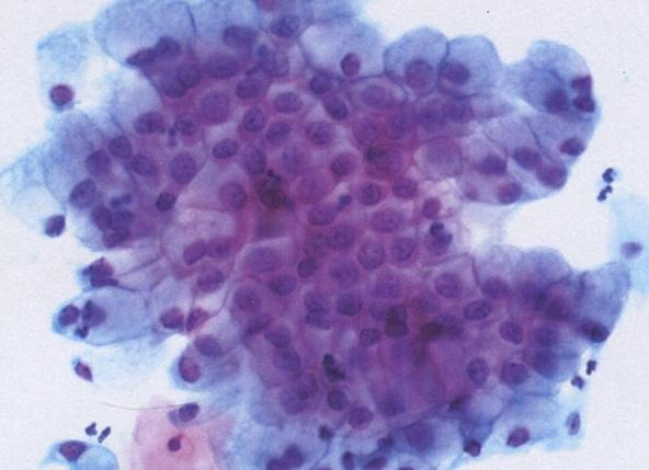 Гомогенная слизь в мазке что это