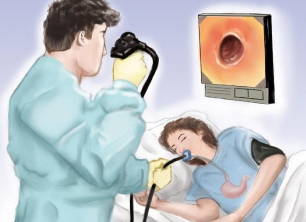 Фгдс как правильно пройти