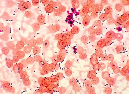 Энтерококки в мазке у женщин