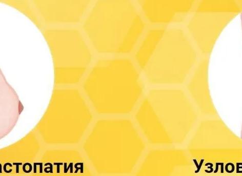 Диффузная фиброзно мастопатия