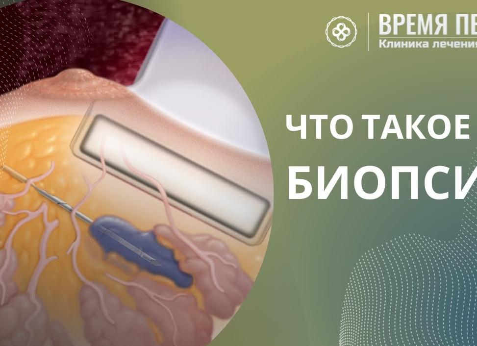 Что такое биопсия
