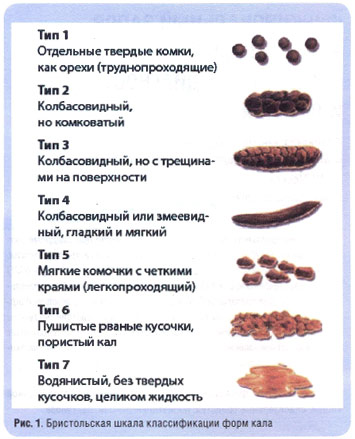 Кал темно коричневого цвета причины