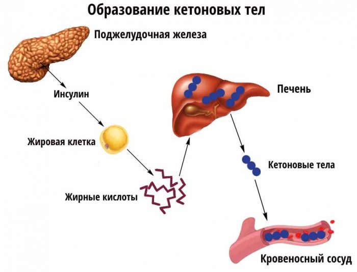 Кетоновые тела в моче причины