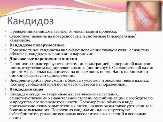 Молочница может быть у мужчин
