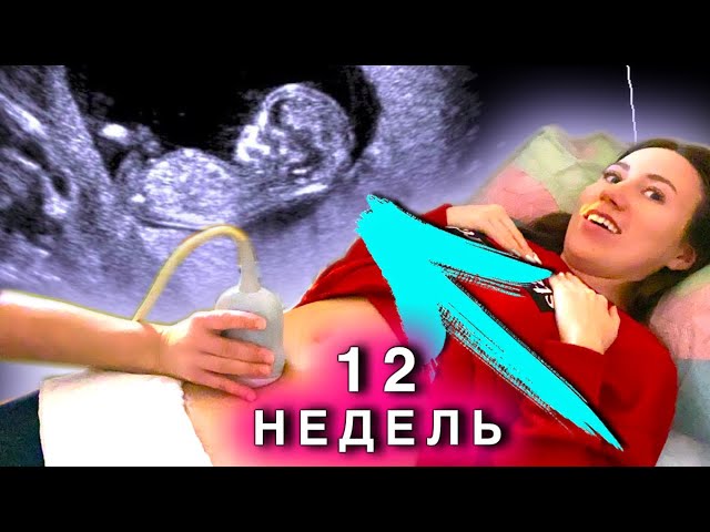 Можно ли в 12 недель определить пол ребенка по узи скрининг