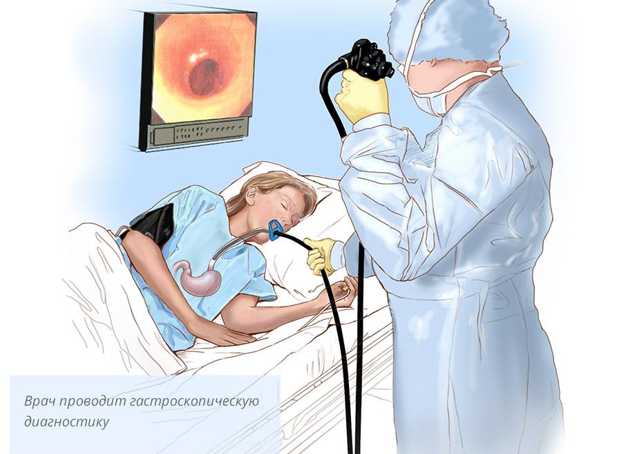 Гастроскопия желудка под наркозом