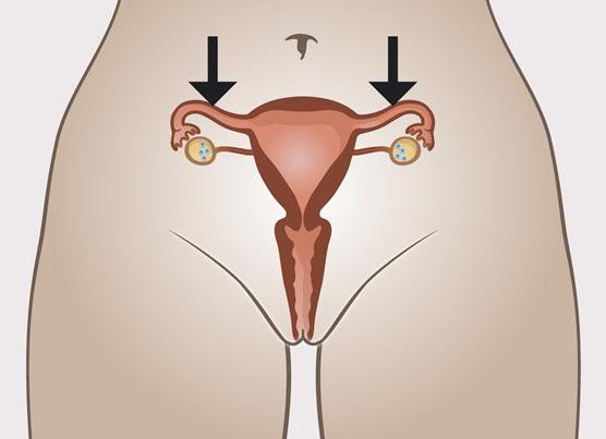 Фаллопиевы трубы у женщин