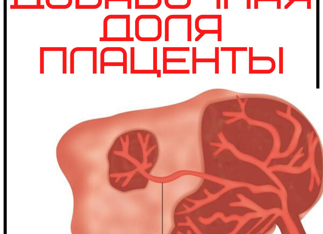 Добавочная доля плаценты что это такое