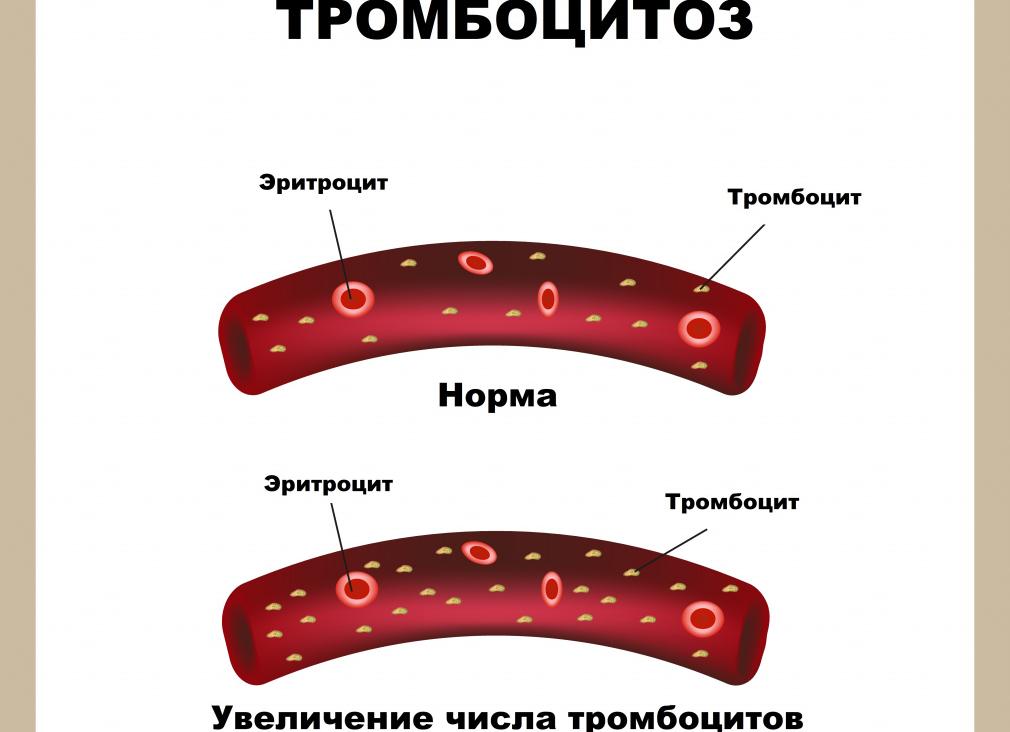 Что такое тромбокрит в крови повышены