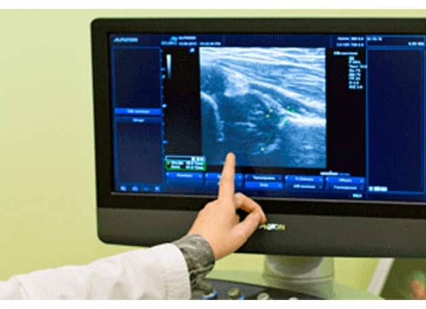 Что лучше узи или рентген тазобедренного сустава