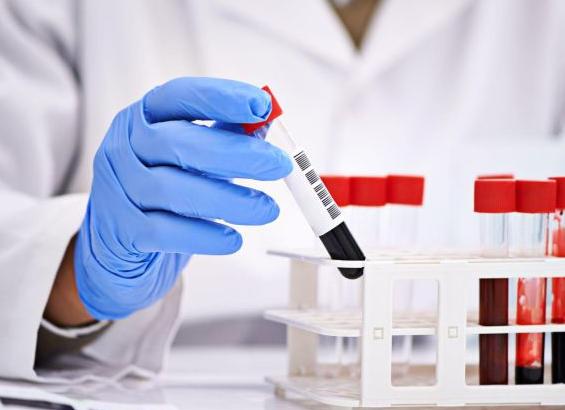 Анализы на ферменты