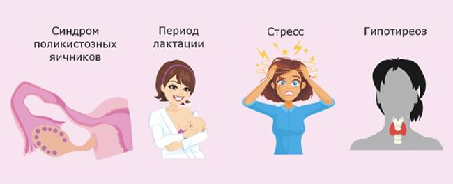 Гормон стресса у женщин пролактин