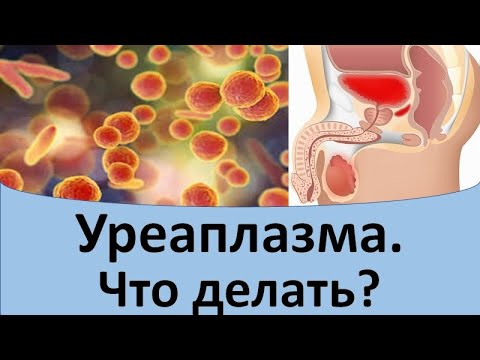 Как сдавать анализ уреаплазма