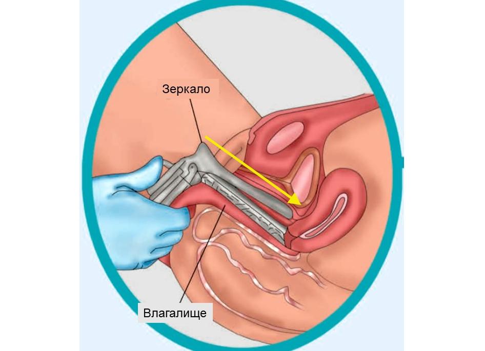 Матка женщины фото внутри через зеркало
