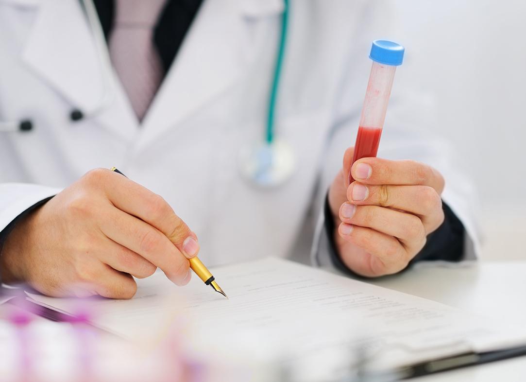 Ложноположительный анализ на гепатит с