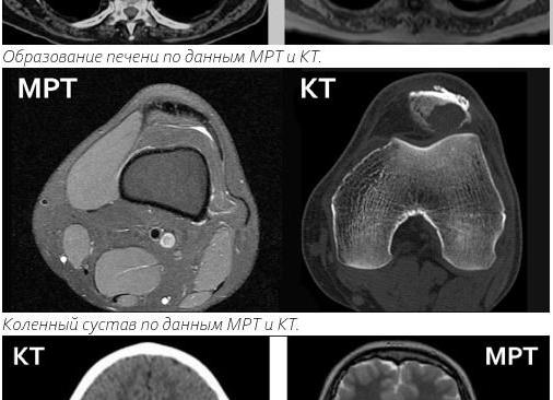 Что лучше кт или мрт печени