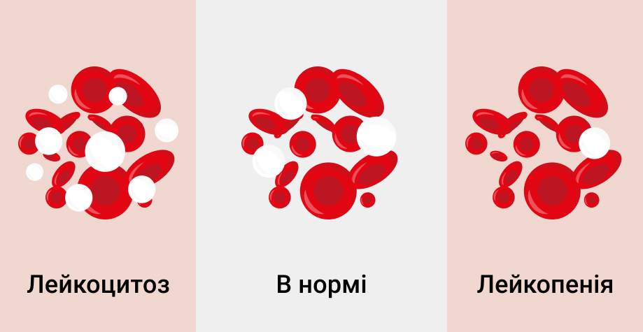 Лейкоцитоз что это такое у детей