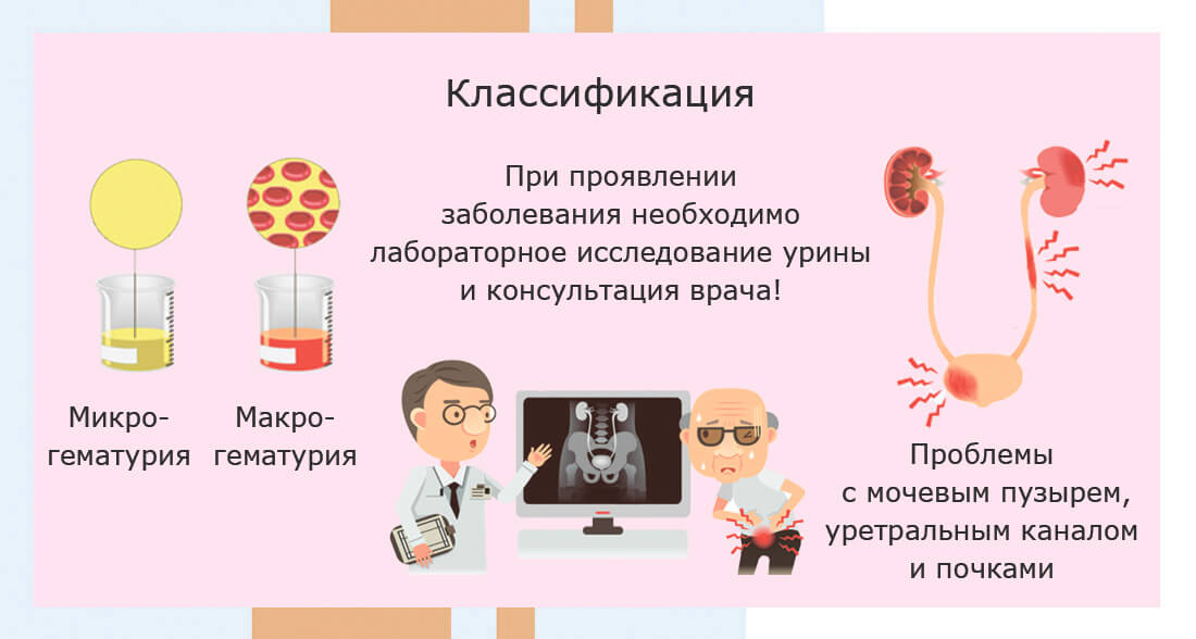Макрогематурия что это