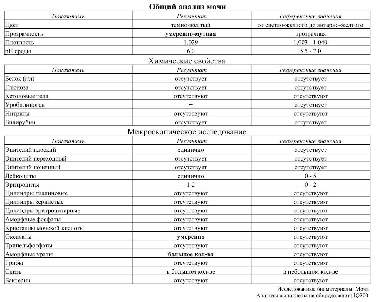 Микроскопическое исследование мочи