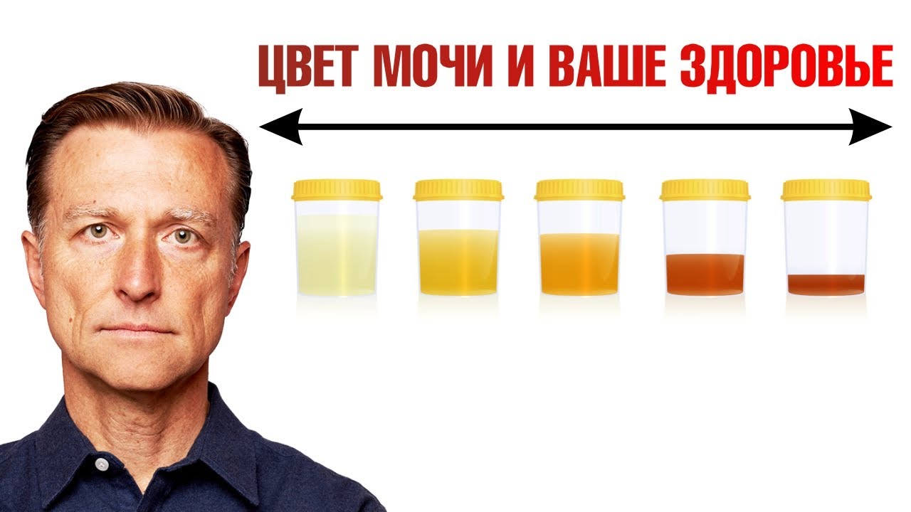 Моча темного цвета у мужчин