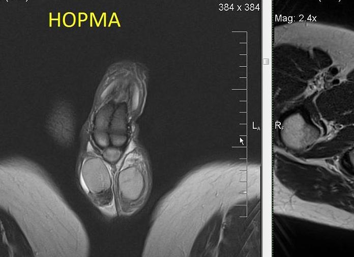 Мрт половых органов