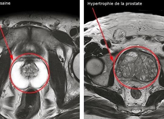 Кт малого таза с контрастом