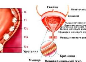 Клетки уретрального и плоского эпителия