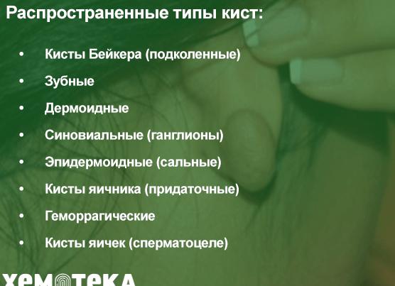 Киста на яичнике причины возникновения у женщин