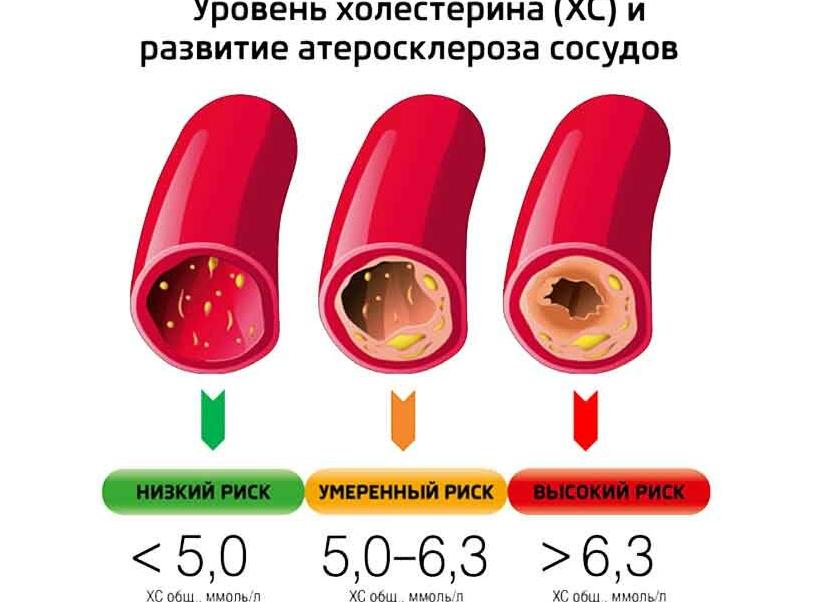 Какой должен быть холестерин