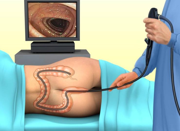 Как подготовиться к проктологу