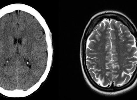 Чем мрт отличается от ркт