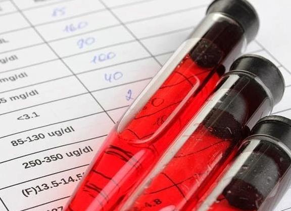 Асло в крови что показывает у детей