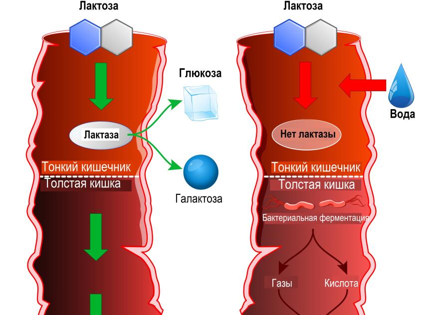 Анализ на непереносимость лактозы