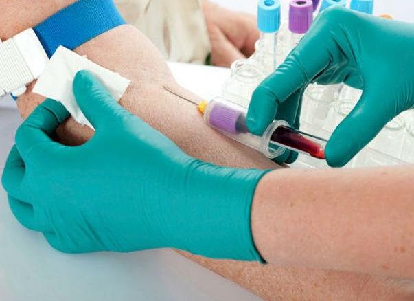 Анализ крови на вич сифилис гепатит Анализ крови на вич сифилис гепатит