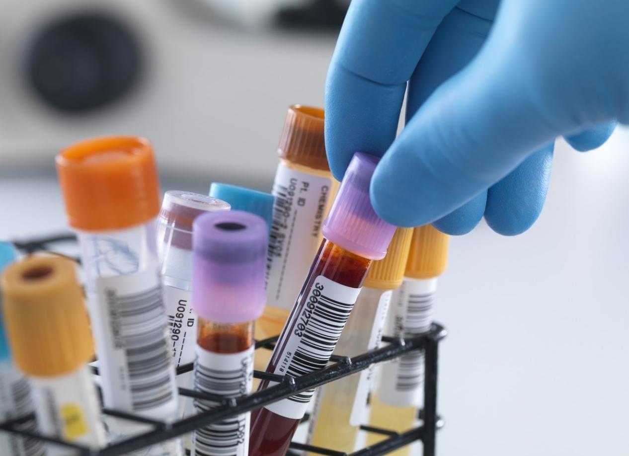 Анализ крови на сахар как правильно сдать Анализ крови на сахар как правильно сдать