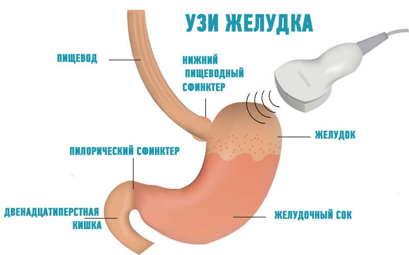 Как делается узи желудка