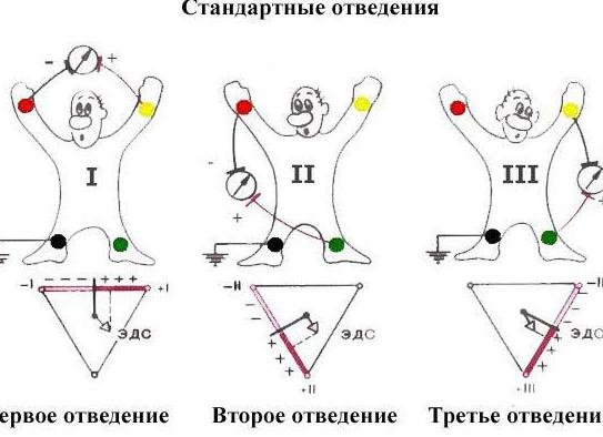Как делать экг