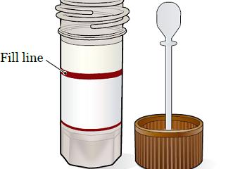 Как берут анализ на хеликобактер пилори при фгдс
