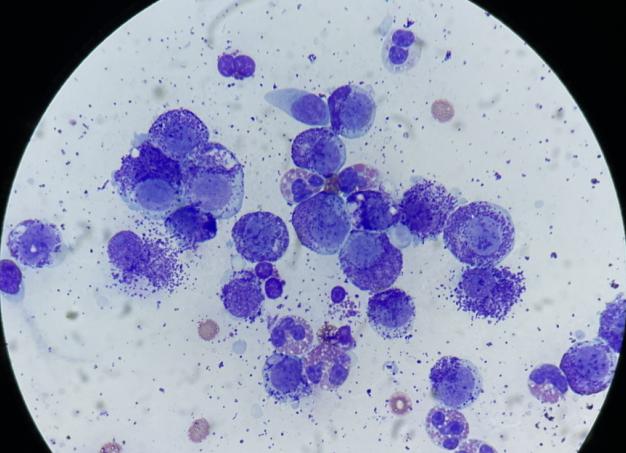 Цитологическое исследование мочи